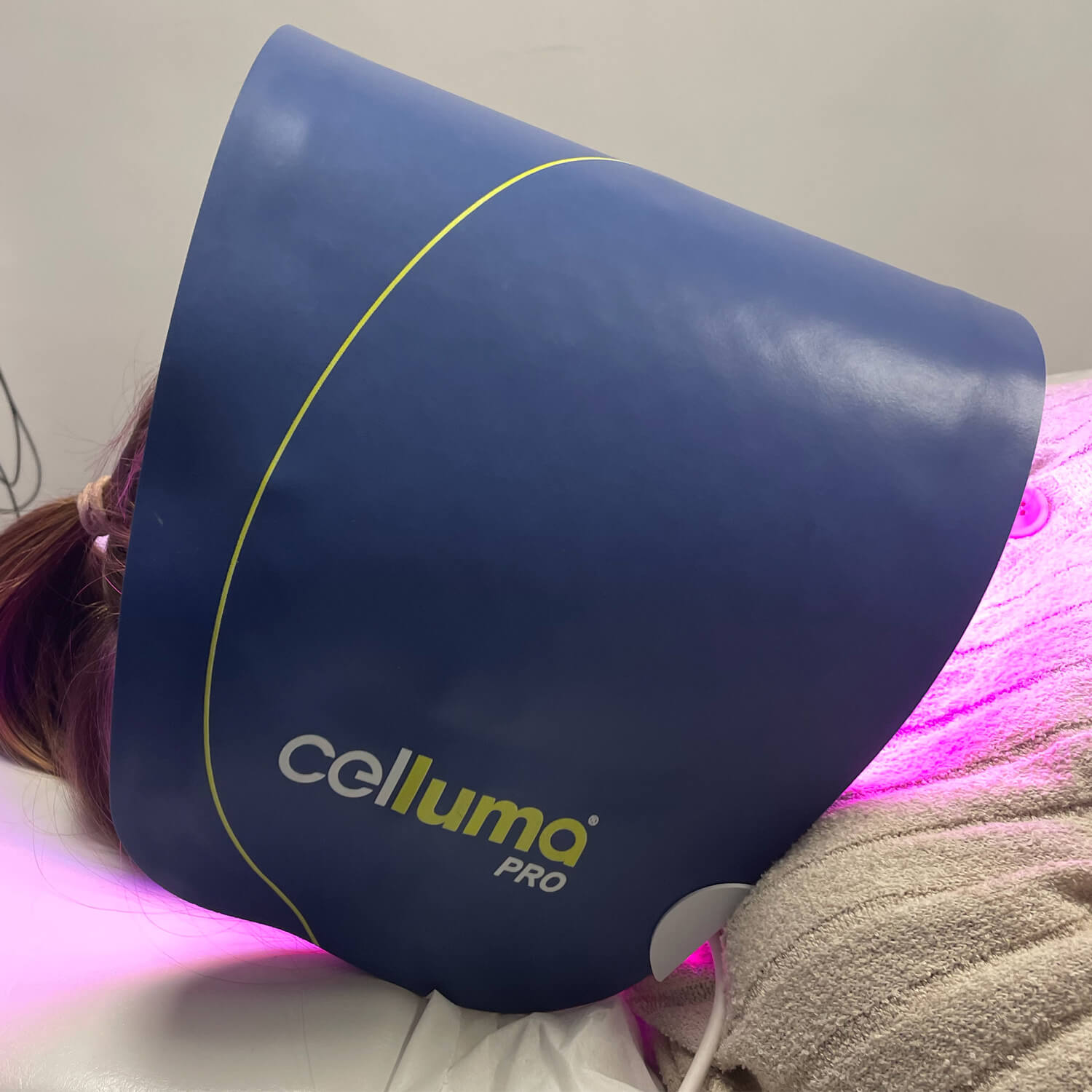 celluma treatment